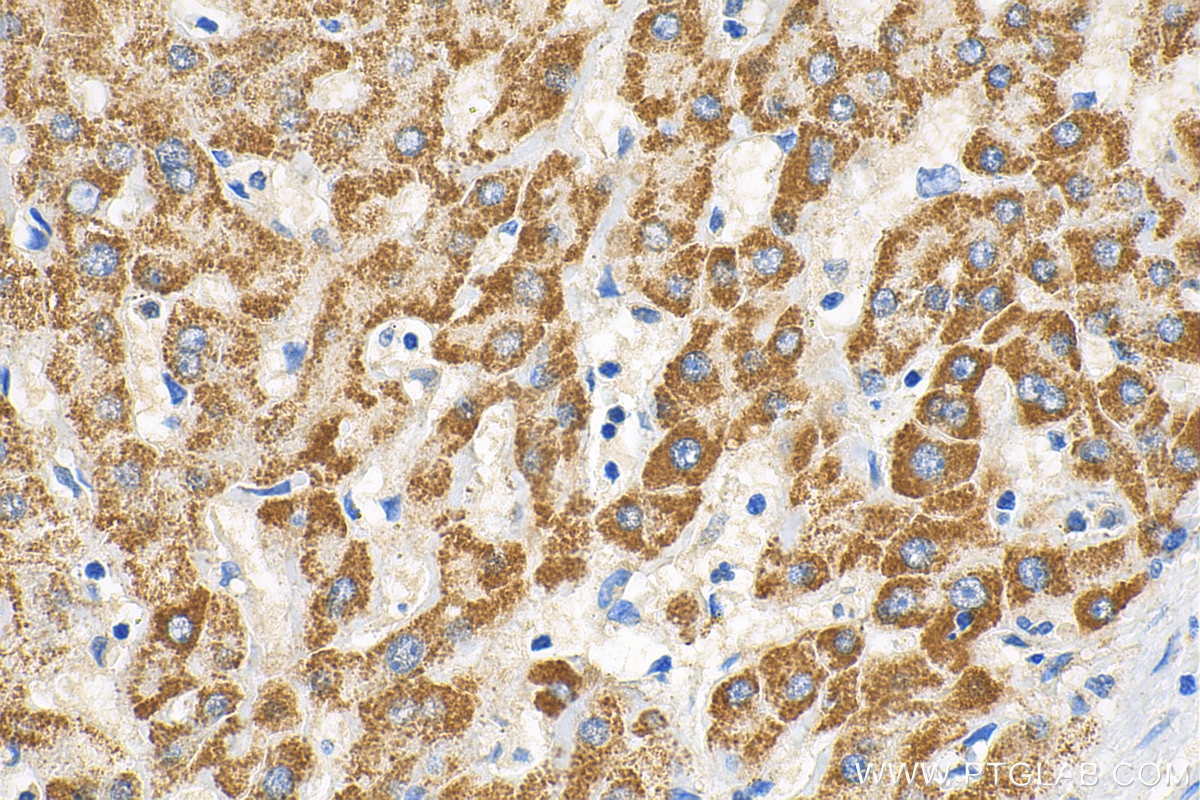 Immunohistochemistry (IHC) staining of human liver tissue using NEDD1 Polyclonal antibody (13993-1-AP)
