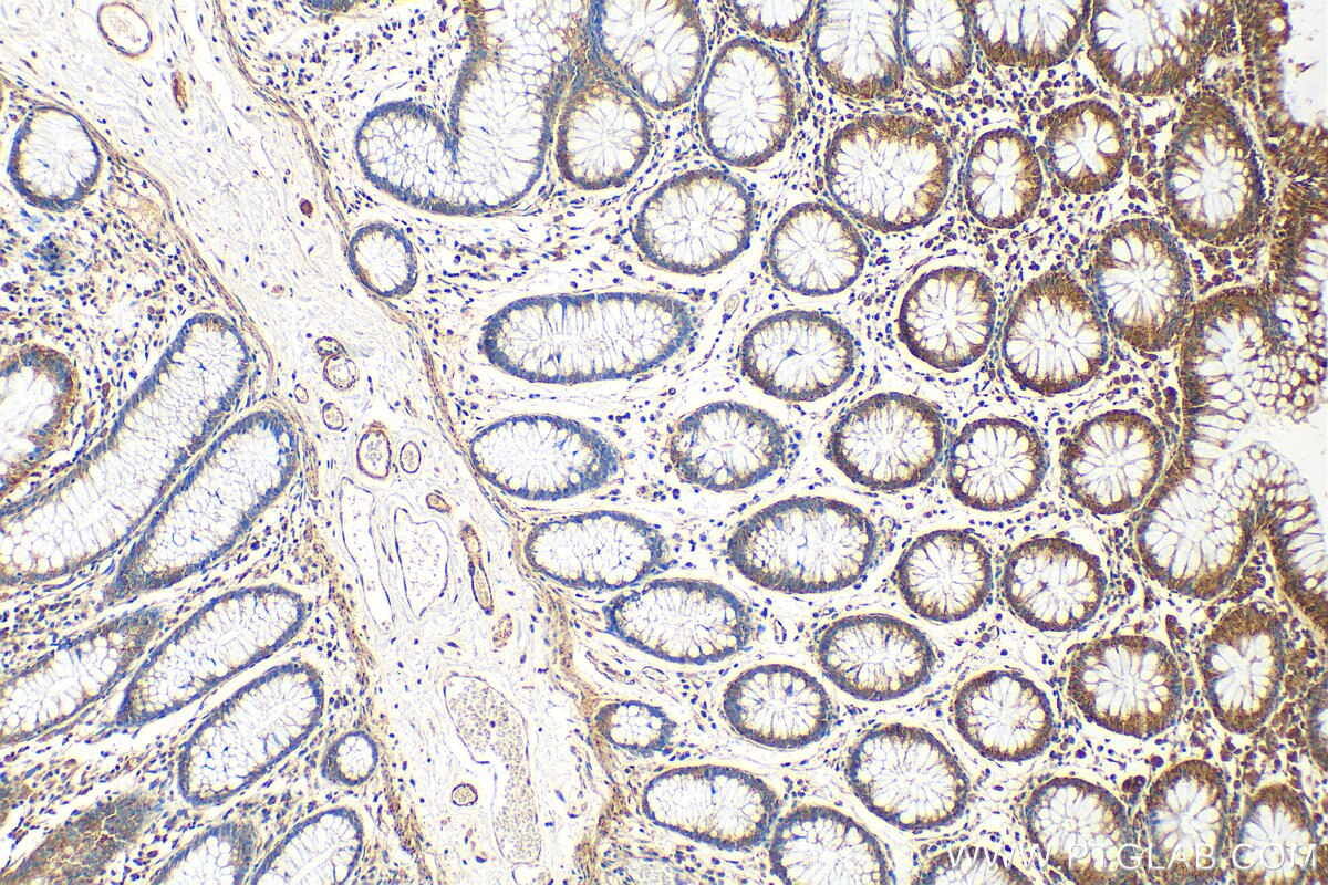 Immunohistochemistry (IHC) staining of human colon tissue using NEDD1 Polyclonal antibody (13993-1-AP)