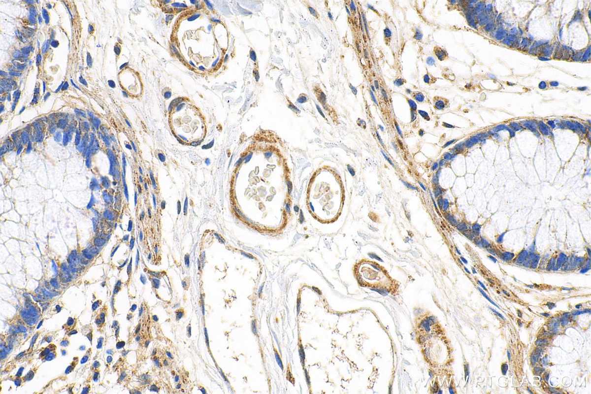 Immunohistochemistry (IHC) staining of human colon tissue using NEDD1 Polyclonal antibody (13993-1-AP)