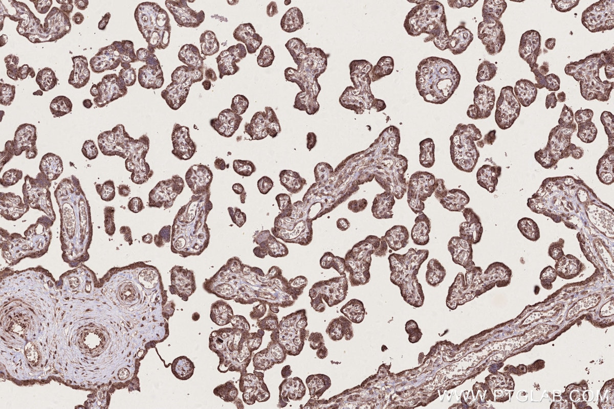 Immunohistochemistry (IHC) staining of human placenta tissue using NEDD1 Polyclonal antibody (13993-1-AP)