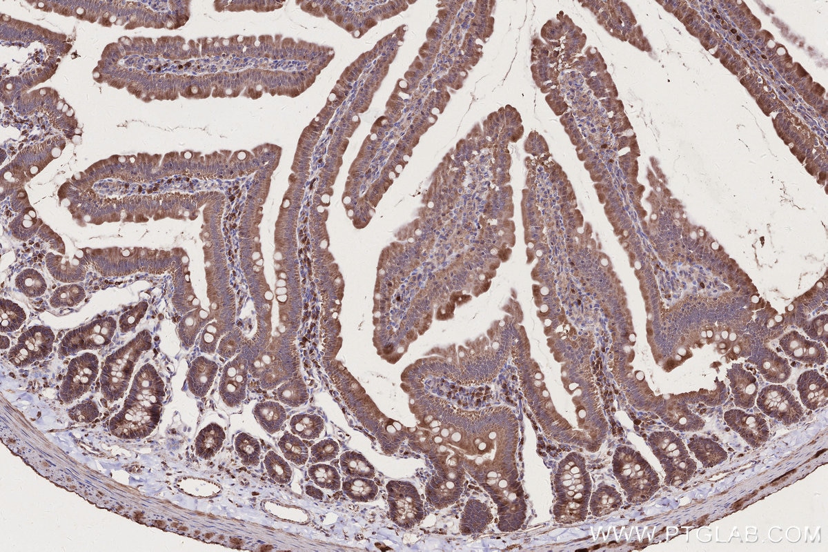 Immunohistochemistry (IHC) staining of rat small intestine tissue using NEDD1 Polyclonal antibody (13993-1-AP)