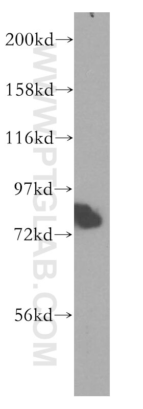 Western Blot (WB) analysis of human brain tissue using NEDD1 Polyclonal antibody (13993-1-AP)