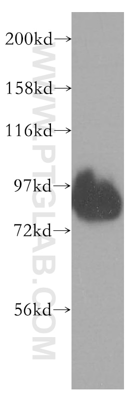Western Blot (WB) analysis of SH-SY5Y cells using NEDD1 Polyclonal antibody (13993-1-AP)