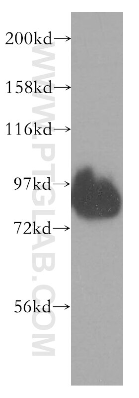 WB analysis of SH-SY5Y using 13993-1-AP