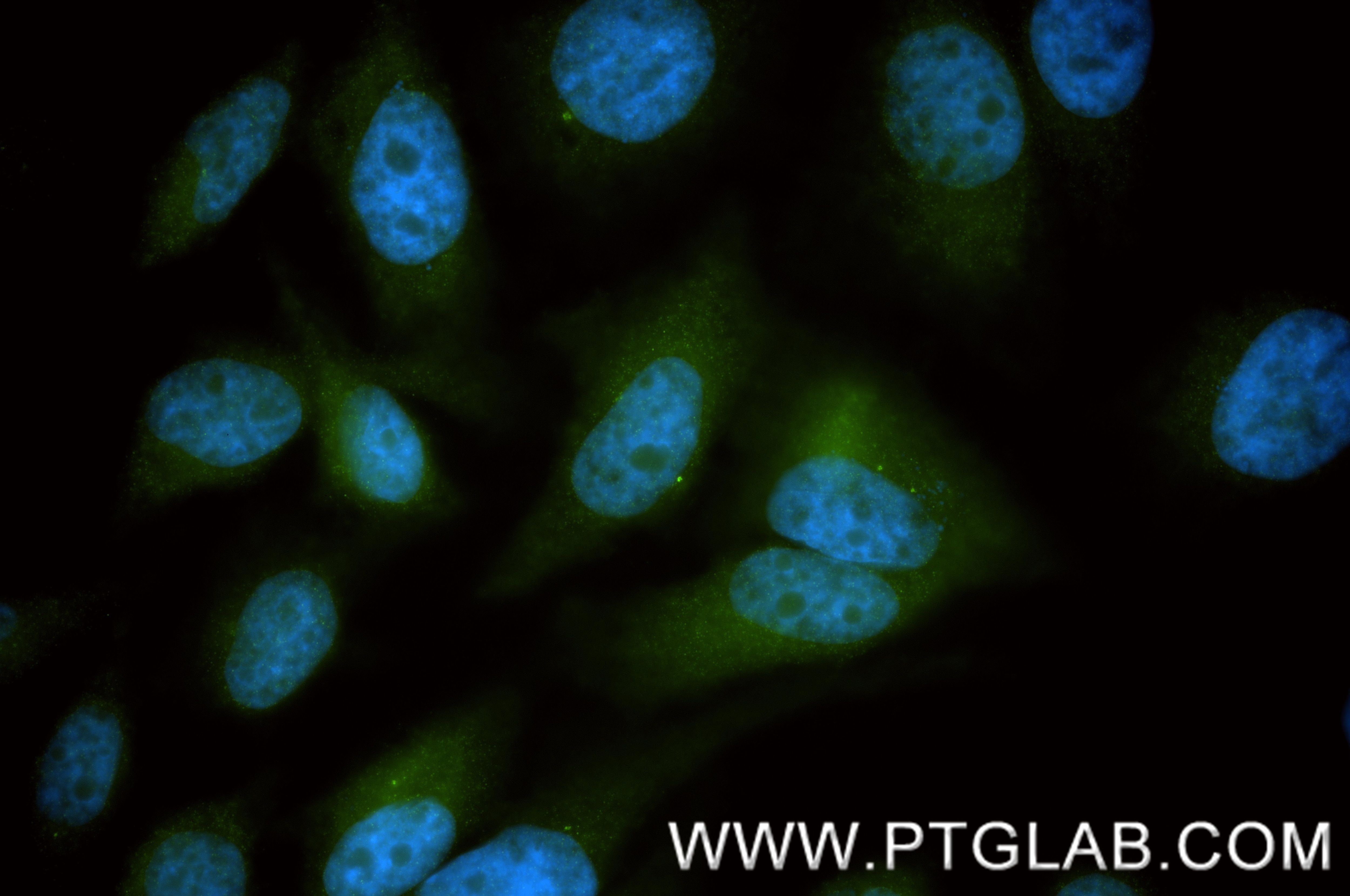 Immunofluorescence (IF) / fluorescent staining of HeLa cells using NEDD1 Recombinant antibody (83443-6-RR)