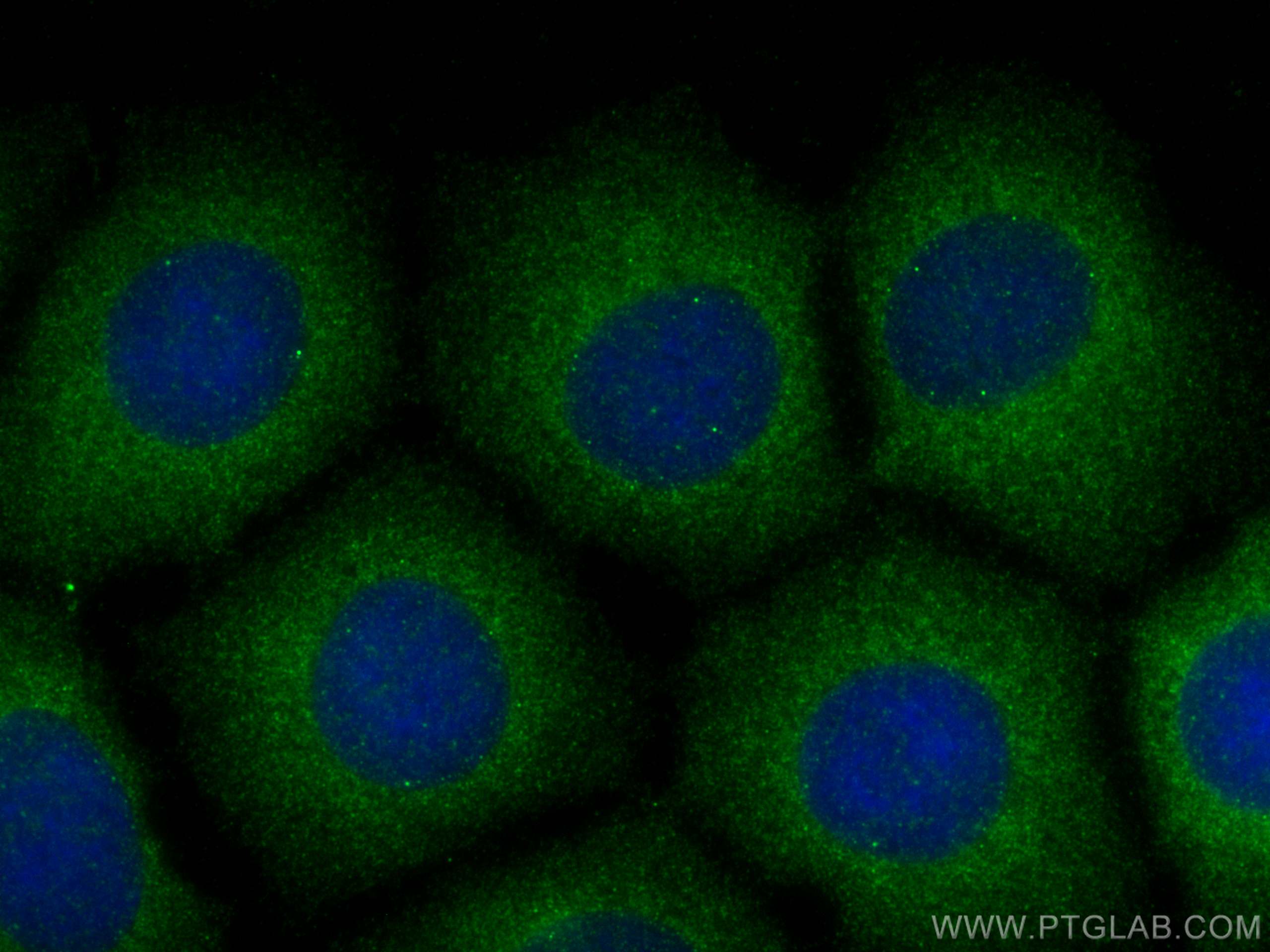 Immunofluorescence (IF) / fluorescent staining of U2OS cells using NEDD4 Polyclonal antibody (21698-1-AP)