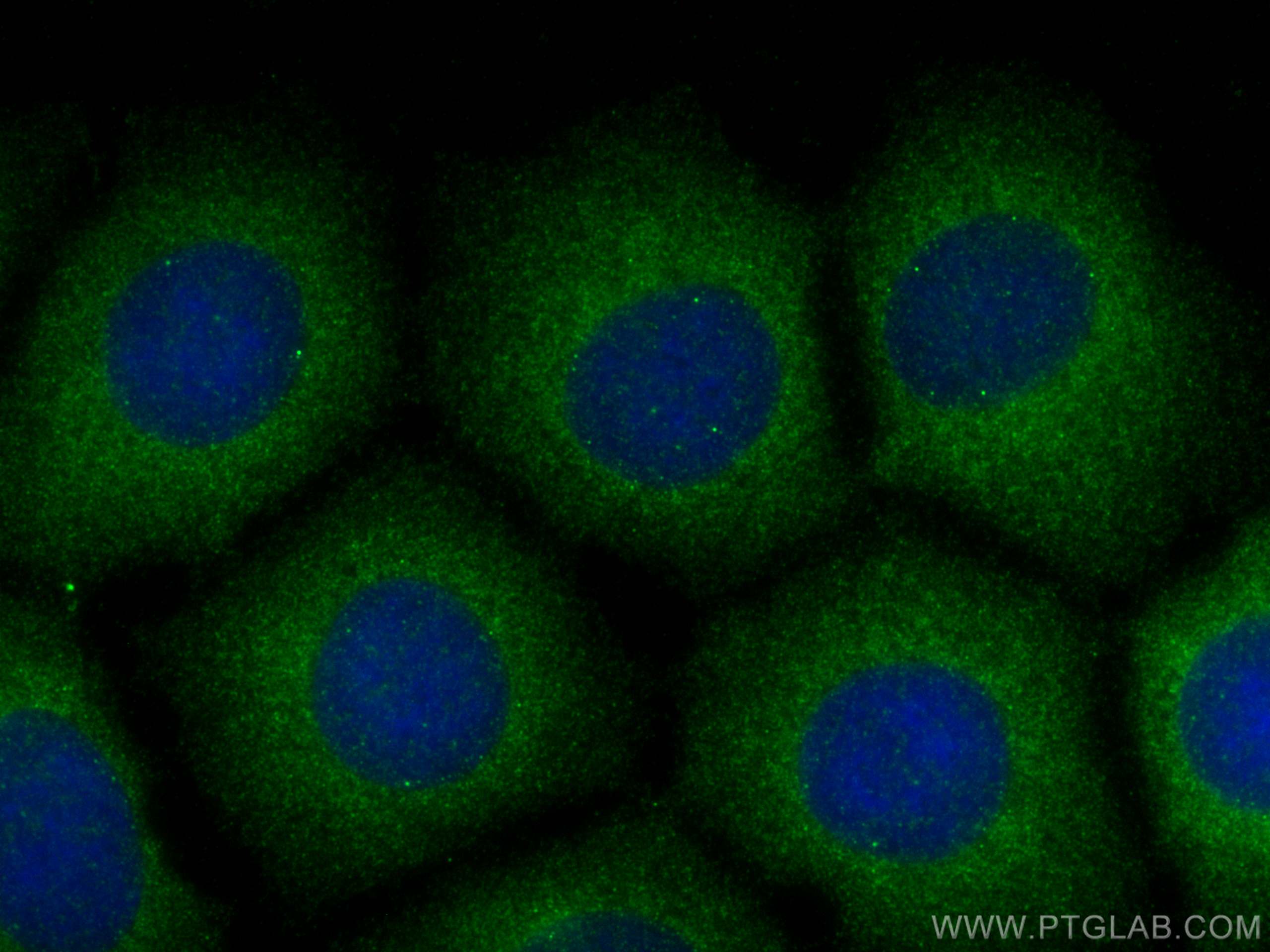 IF Staining of U2OS using 21698-1-AP