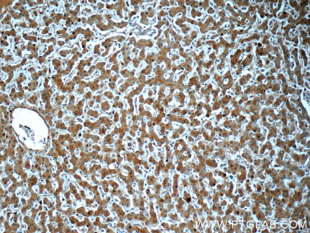 Immunohistochemistry (IHC) staining of human liver tissue using NEDD4 Polyclonal antibody (21698-1-AP)