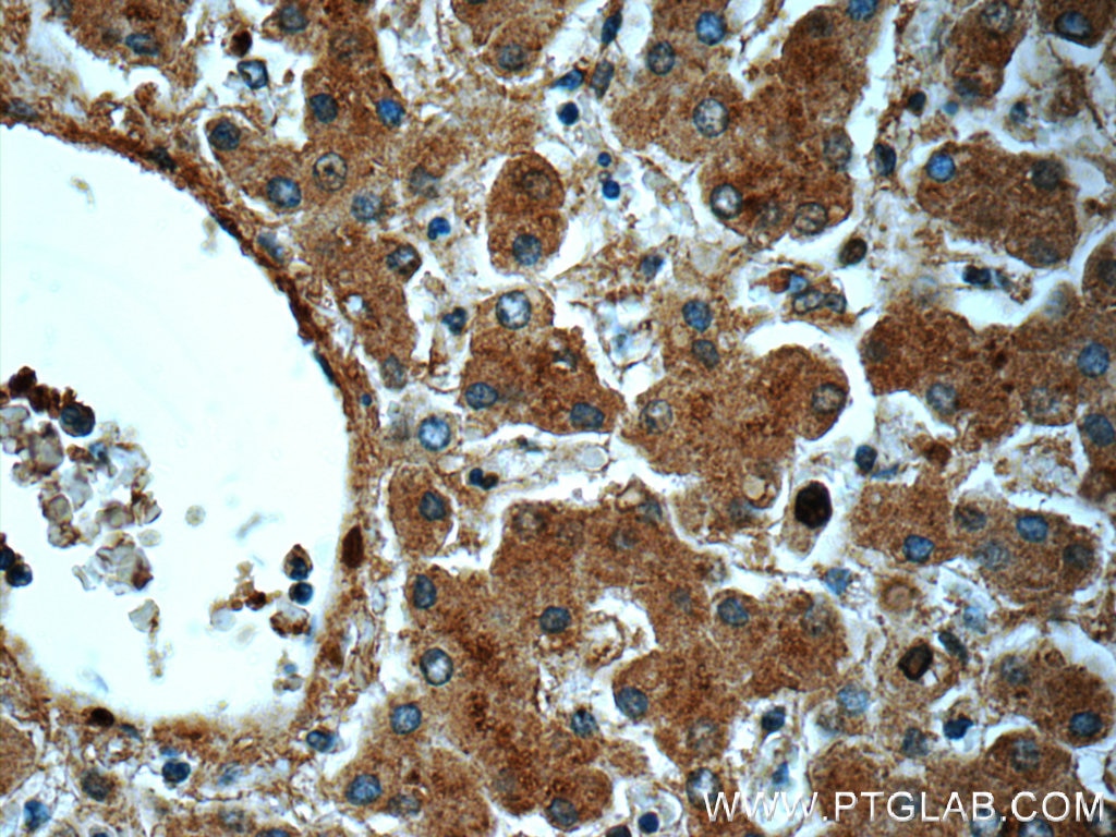 Immunohistochemistry (IHC) staining of human liver tissue using NEDD4 Polyclonal antibody (21698-1-AP)