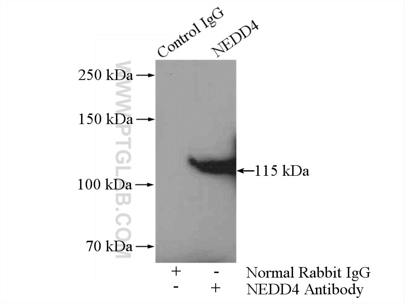 Immunoprecipitation (IP) experiment of C6 cells using NEDD4 Polyclonal antibody (21698-1-AP)