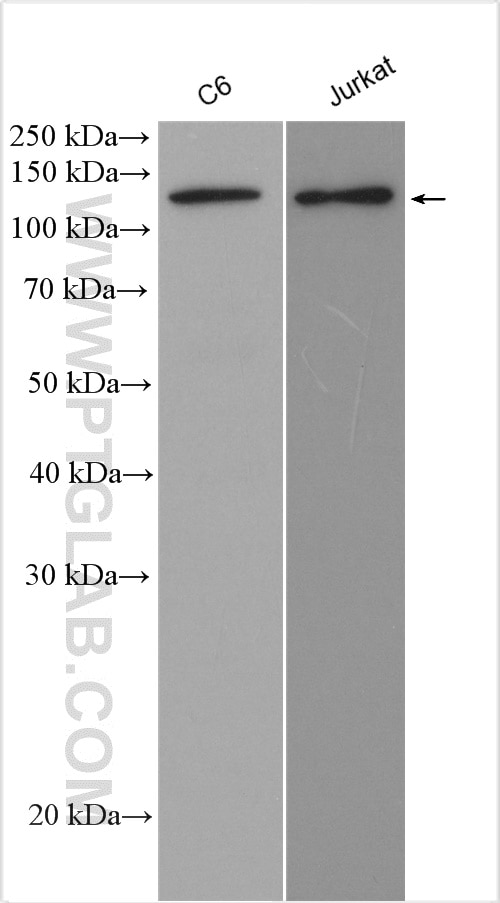 Western Blot (WB) analysis of various lysates using NEDD4 Polyclonal antibody (21698-1-AP)