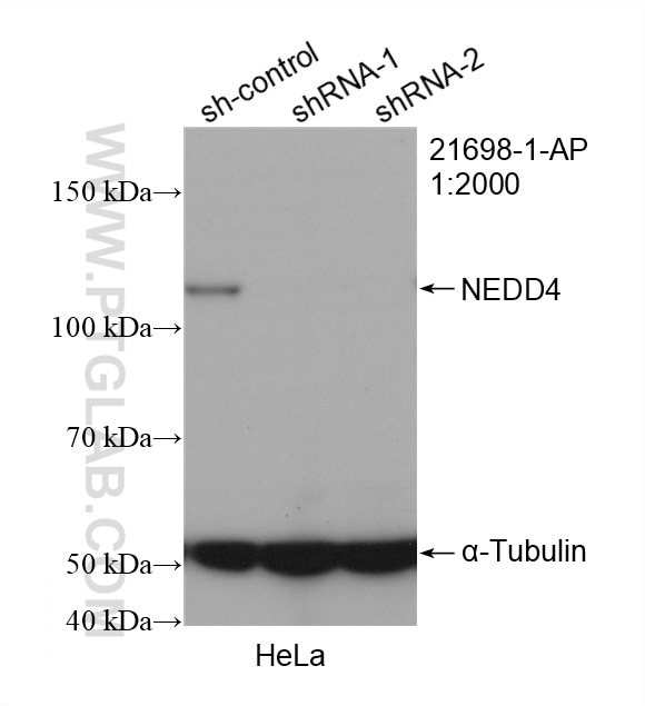 Western Blot (WB) analysis of HeLa cells using NEDD4 Polyclonal antibody (21698-1-AP)