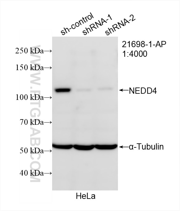 Western Blot (WB) analysis of HeLa cells using NEDD4 Polyclonal antibody (21698-1-AP)