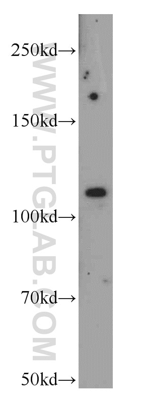 Western Blot (WB) analysis of HT-1080 cells using NEDD4 Polyclonal antibody (21698-1-AP)