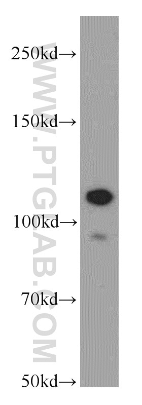 Western Blot (WB) analysis of A549 cells using NEDD4 Polyclonal antibody (21698-1-AP)