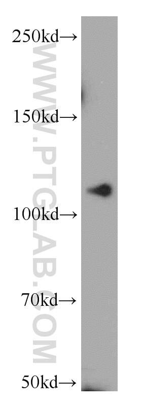 Western Blot (WB) analysis of COS-7 cells using NEDD4 Polyclonal antibody (21698-1-AP)
