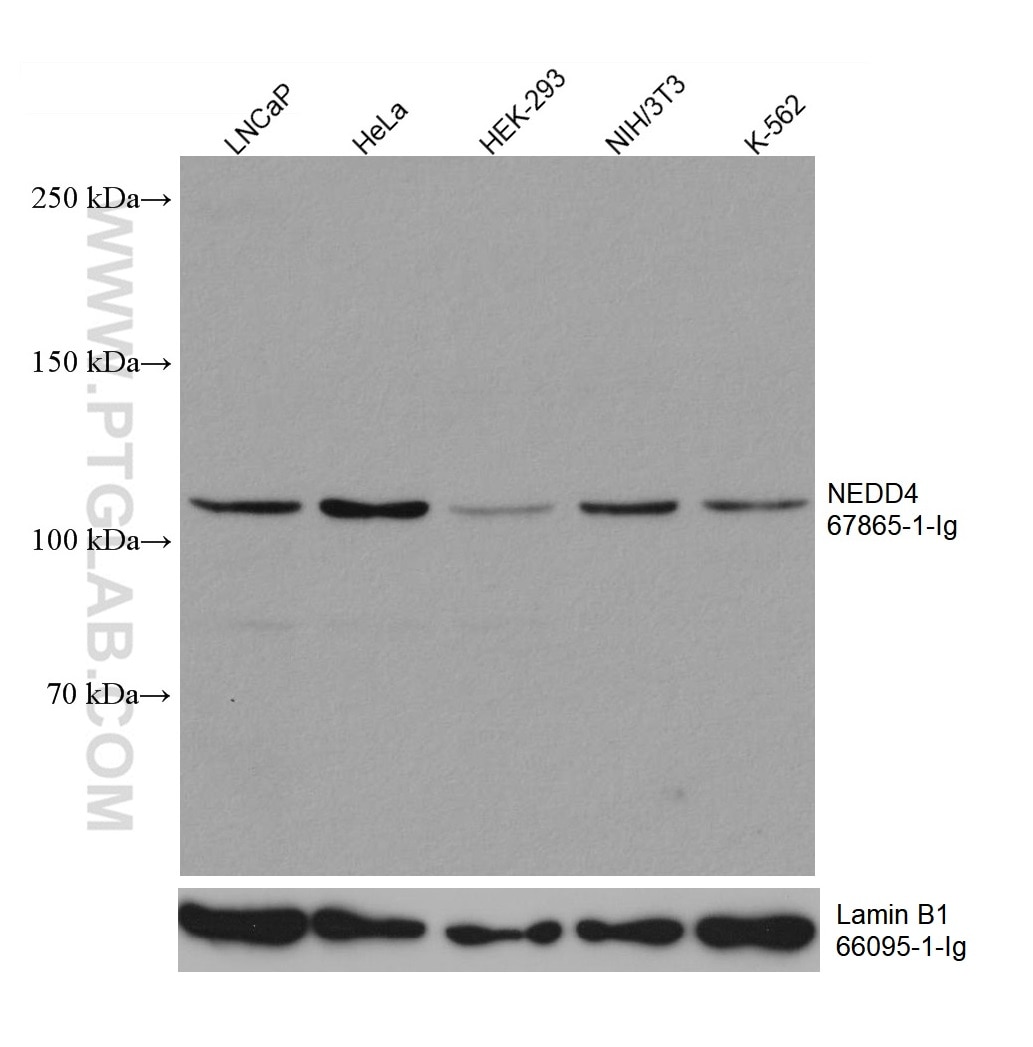 Western Blot (WB) analysis of various lysates using NEDD4 Monoclonal antibody (67865-1-Ig)