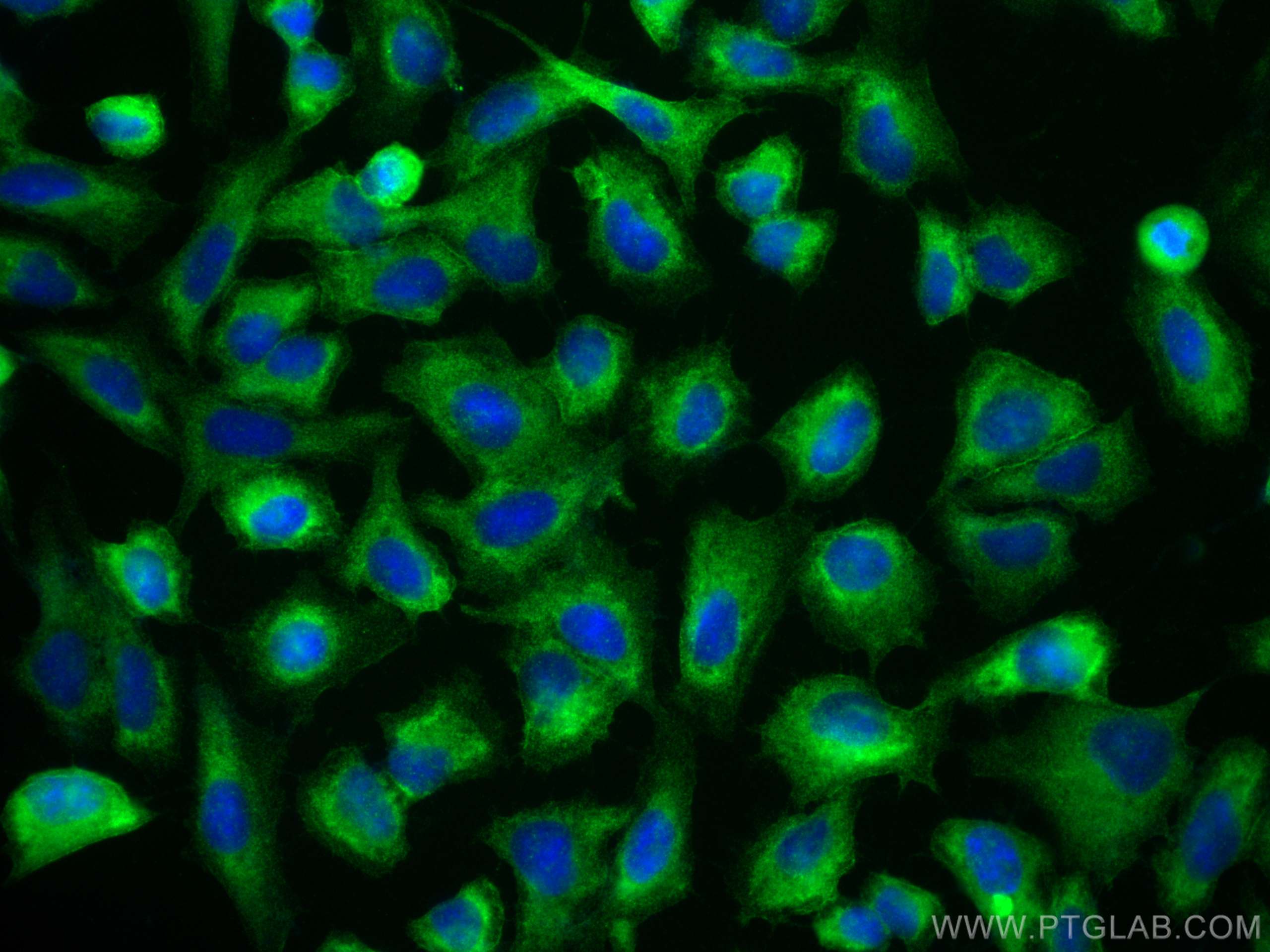 Immunofluorescence (IF) / fluorescent staining of U2OS cells using NEDD4 Recombinant antibody (83112-4-RR)