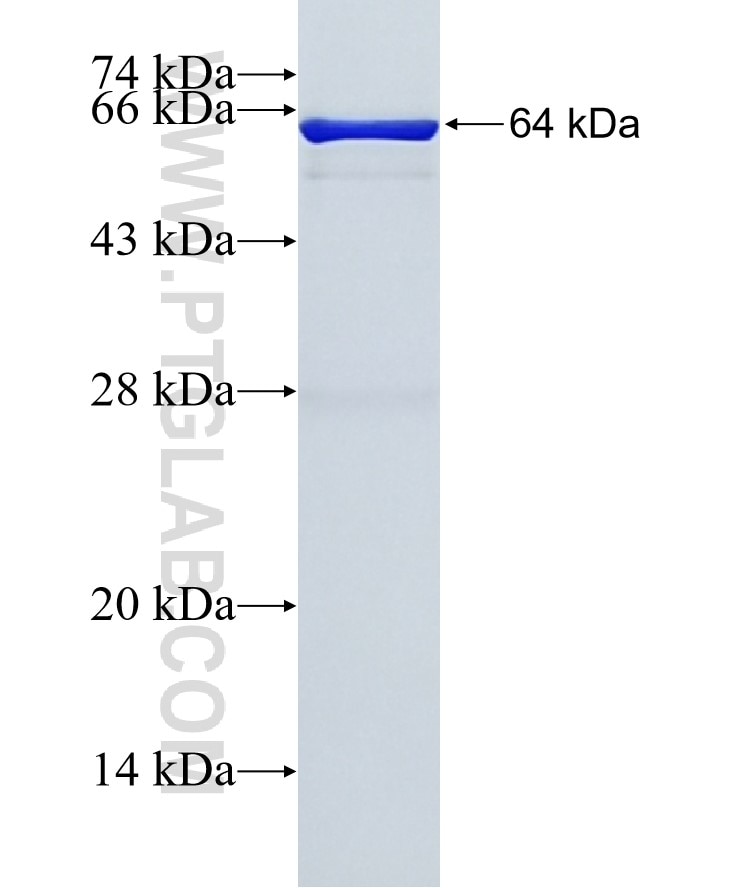 NEDD4 fusion protein Ag16291 SDS-PAGE