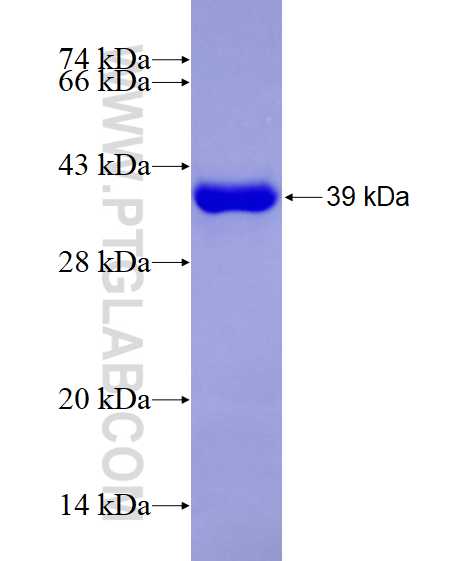 NEDD4 fusion protein Ag17124 SDS-PAGE