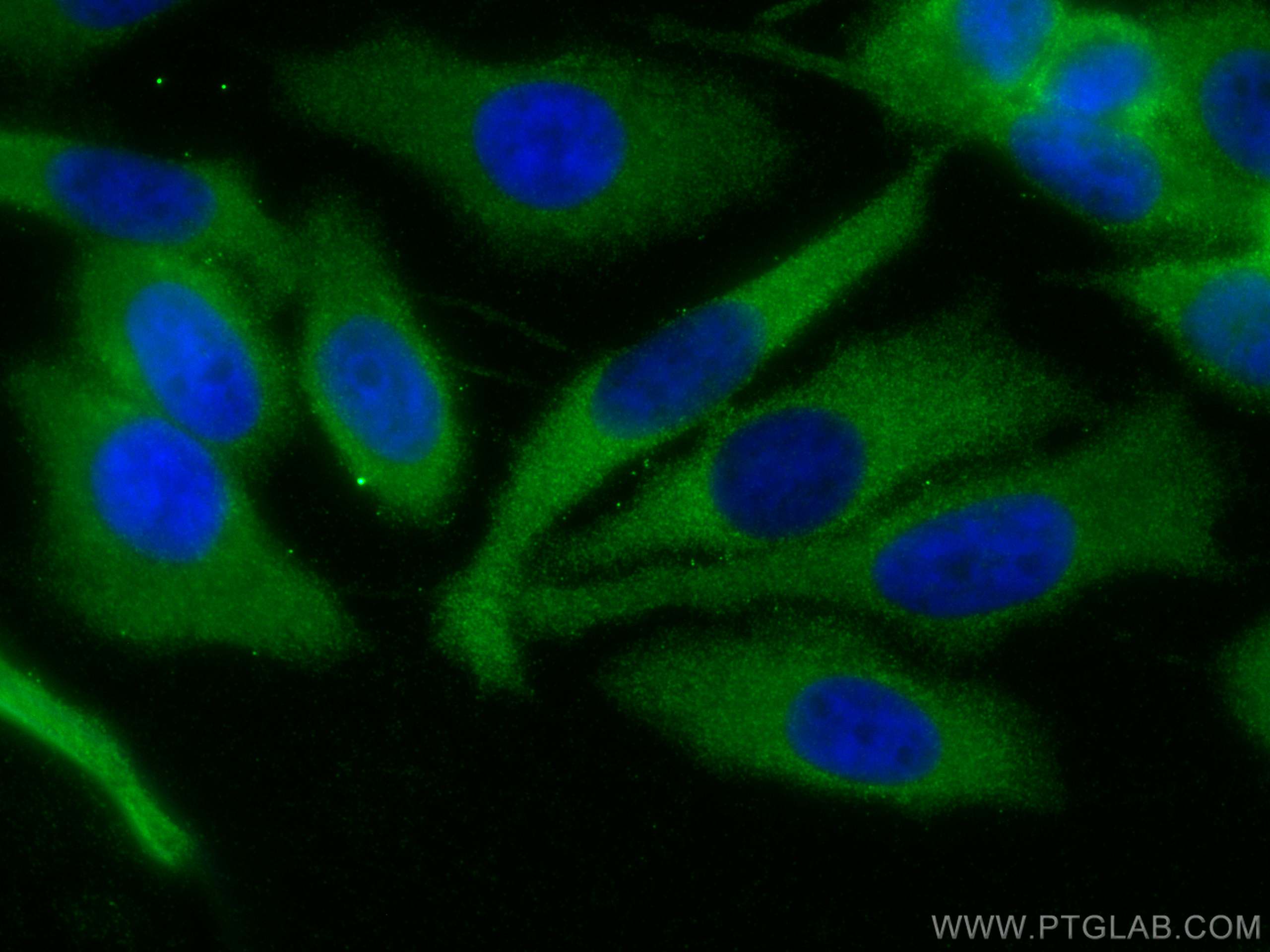 Immunofluorescence (IF) / fluorescent staining of PC-3 cells using NEDD4L Polyclonal antibody (13690-1-AP)