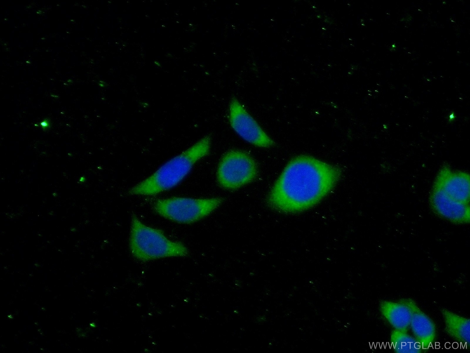 Immunofluorescence (IF) / fluorescent staining of PC-3 cells using NEDD4L Polyclonal antibody (13690-1-AP)
