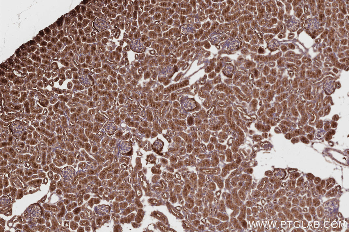 Immunohistochemistry (IHC) staining of mouse kidney tissue using NEDD4L Polyclonal antibody (13690-1-AP)