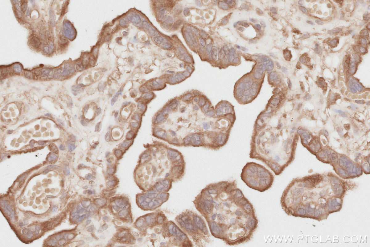 Immunohistochemistry (IHC) staining of human placenta tissue using NEDD4L Polyclonal antibody (13690-1-AP)