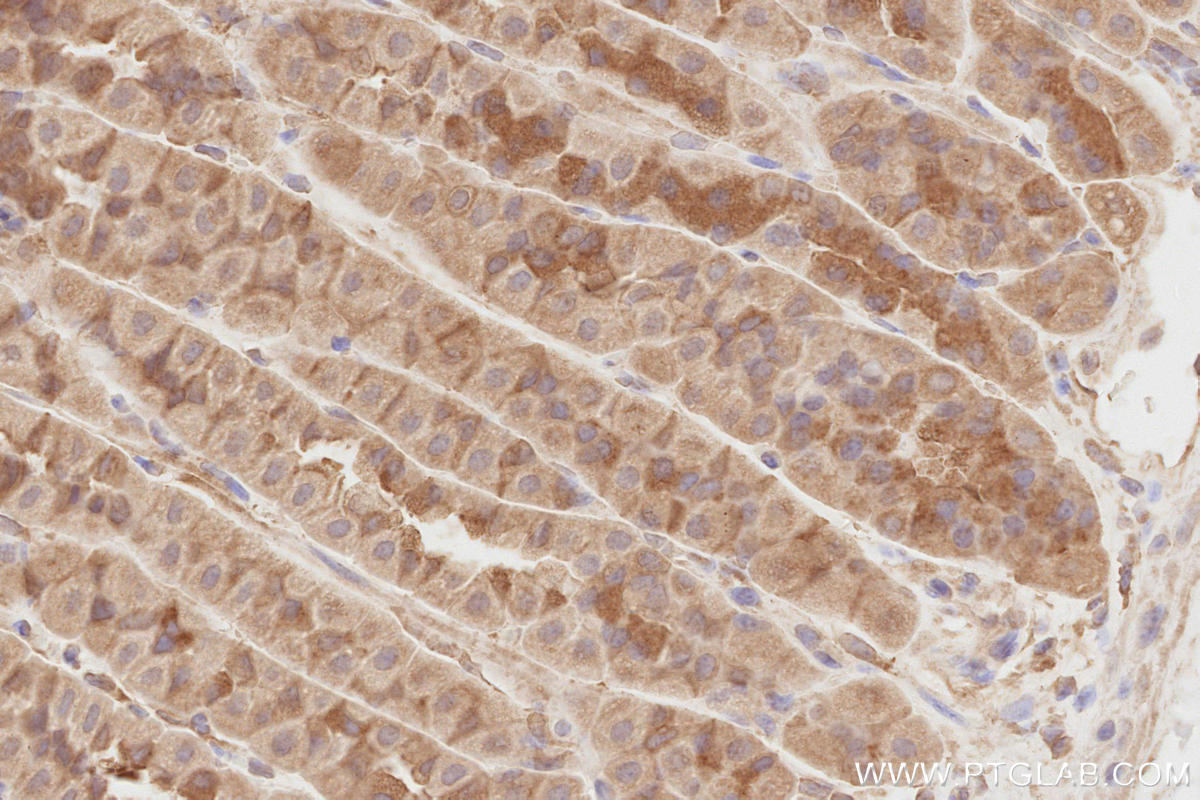 Immunohistochemistry (IHC) staining of mouse stomach tissue using NEDD4L Polyclonal antibody (13690-1-AP)