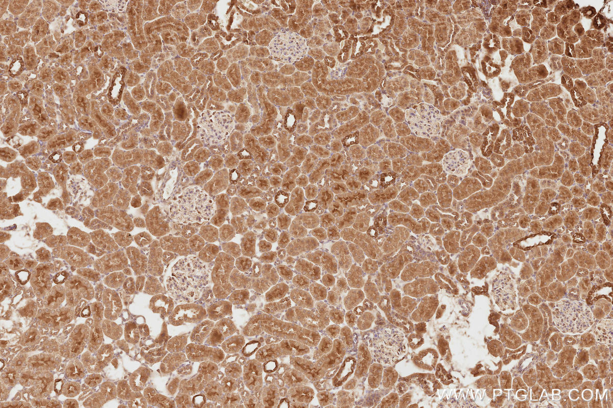 Immunohistochemistry (IHC) staining of rat kidney tissue using NEDD4L Polyclonal antibody (13690-1-AP)