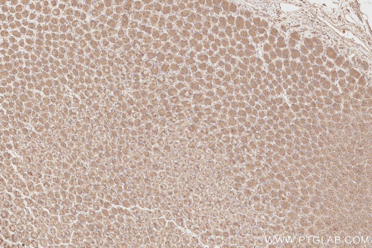 Immunohistochemistry (IHC) staining of rat stomach tissue using NEDD4L Polyclonal antibody (13690-1-AP)