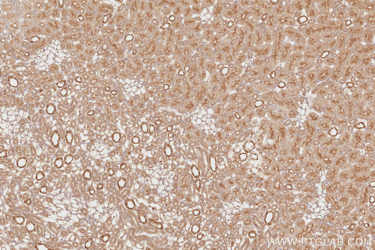 Immunohistochemistry (IHC) staining of rat kidney tissue using NEDD4L Polyclonal antibody (13690-1-AP)