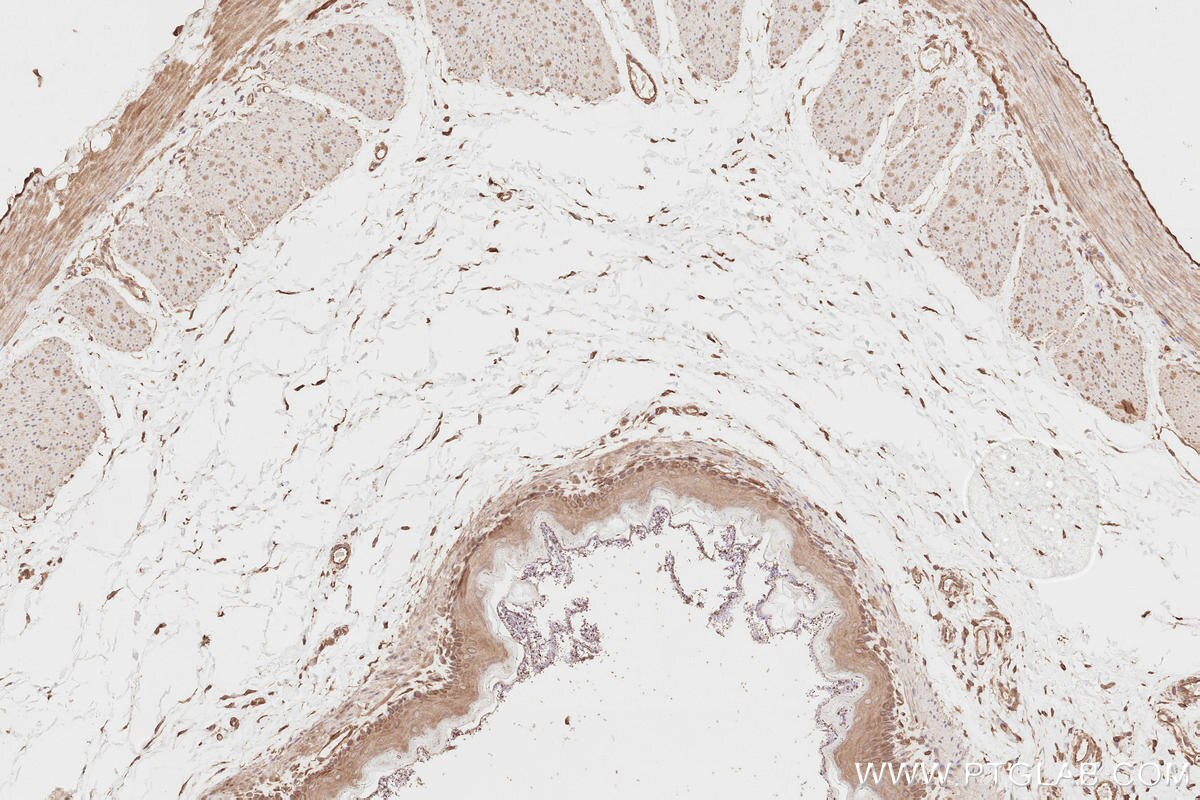 Immunohistochemistry (IHC) staining of rat stomach tissue using NEDD4L Polyclonal antibody (13690-1-AP)
