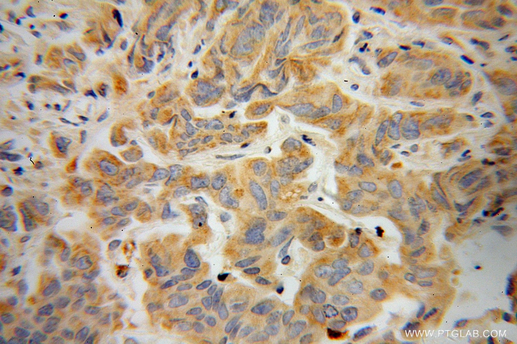 NEDD4L Polyclonal antibody