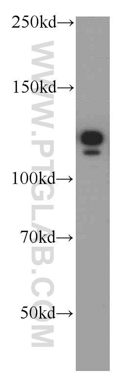 Western Blot (WB) analysis of PC-3 cells using NEDD4L Polyclonal antibody (13690-1-AP)
