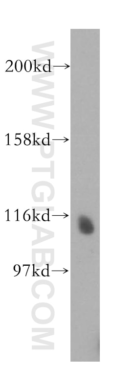 NEDD4L Polyclonal antibody