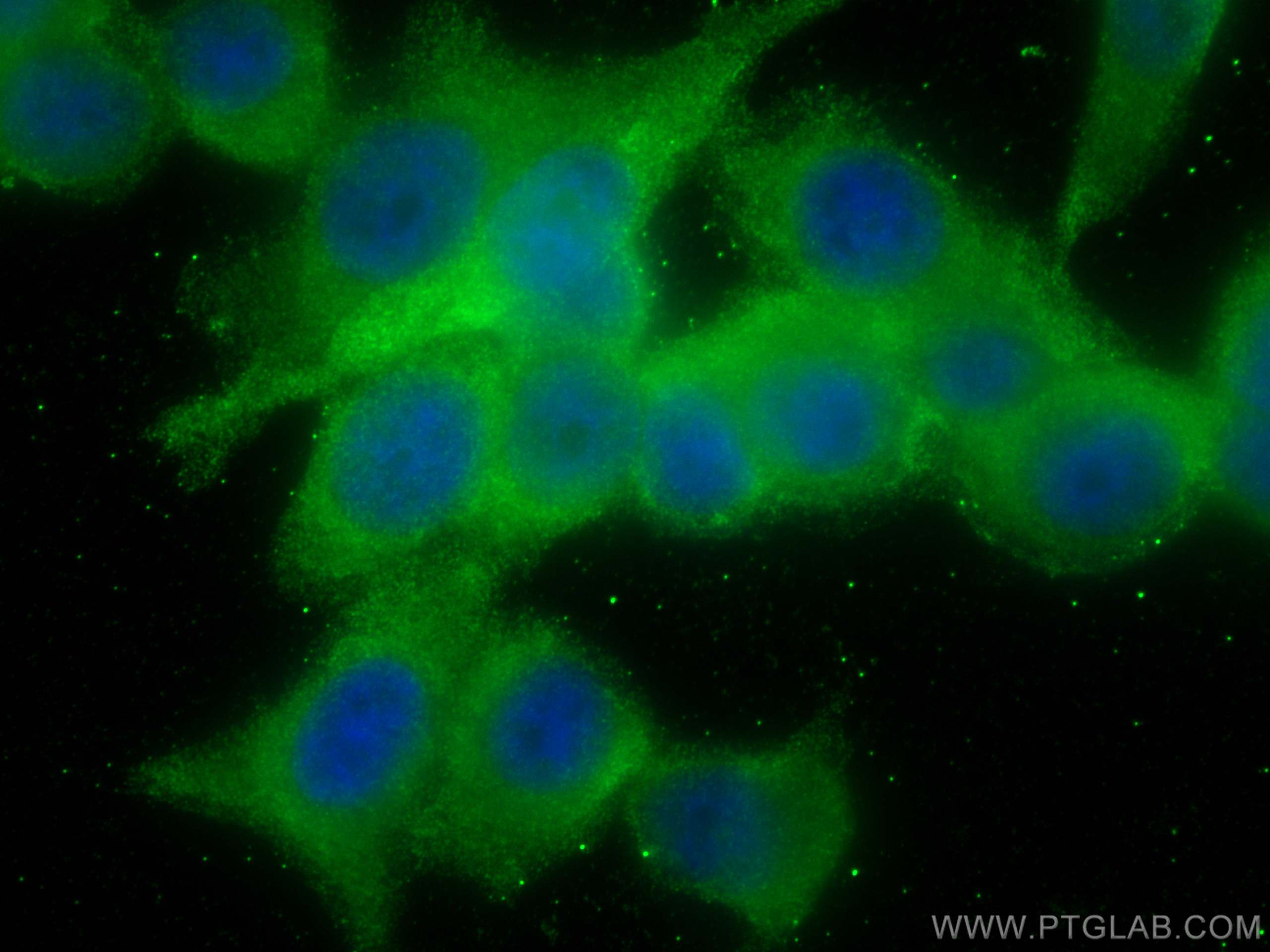 Immunofluorescence (IF) / fluorescent staining of PC-3 cells using NEDD4L Monoclonal antibody (67276-1-Ig)
