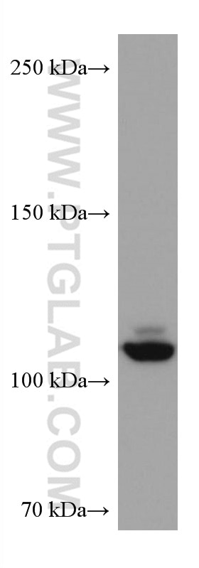 Western Blot (WB) analysis of Jurkat cells using NEDD4L Monoclonal antibody (67276-1-Ig)
