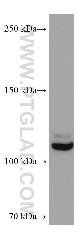 Western Blot (WB) analysis of HSC-T6 cells using NEDD4L Monoclonal antibody (67276-1-Ig)