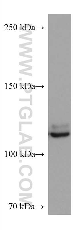 Western Blot (WB) analysis of 4T1 cells using NEDD4L Monoclonal antibody (67276-1-Ig)