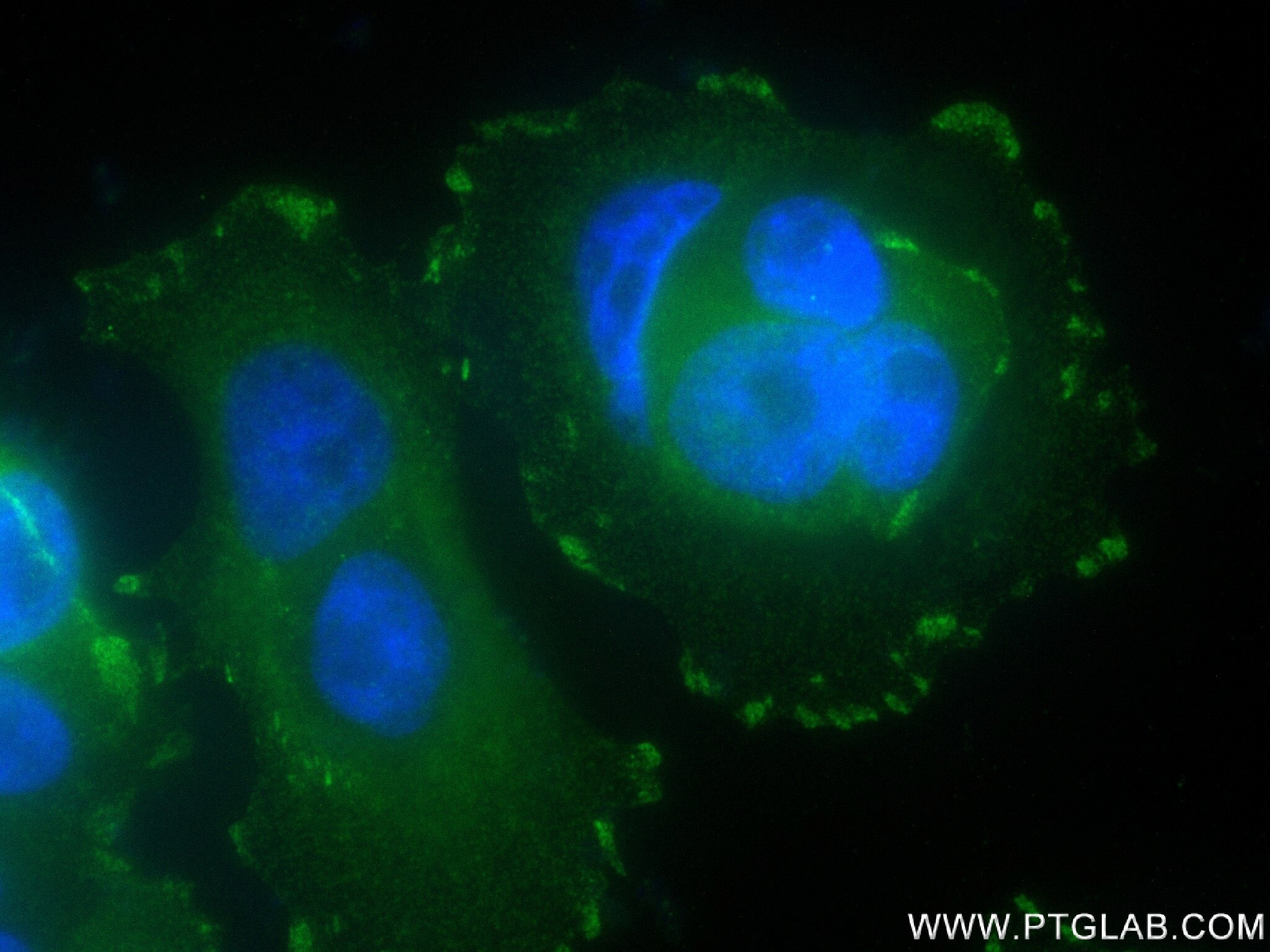 Immunofluorescence (IF) / fluorescent staining of MCF-7 cells using NEDD9 Recombinant antibody (83362-2-RR)