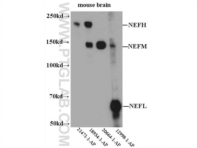 Western Blot (WB) analysis of mouse brain tissue using NF-H/NF200 Polyclonal antibody (18934-1-AP)