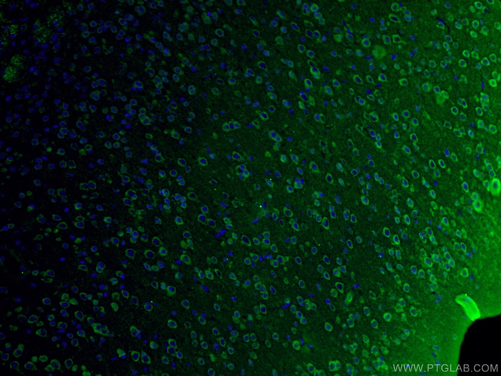 IF Staining of mouse brain using 18934-1-AP