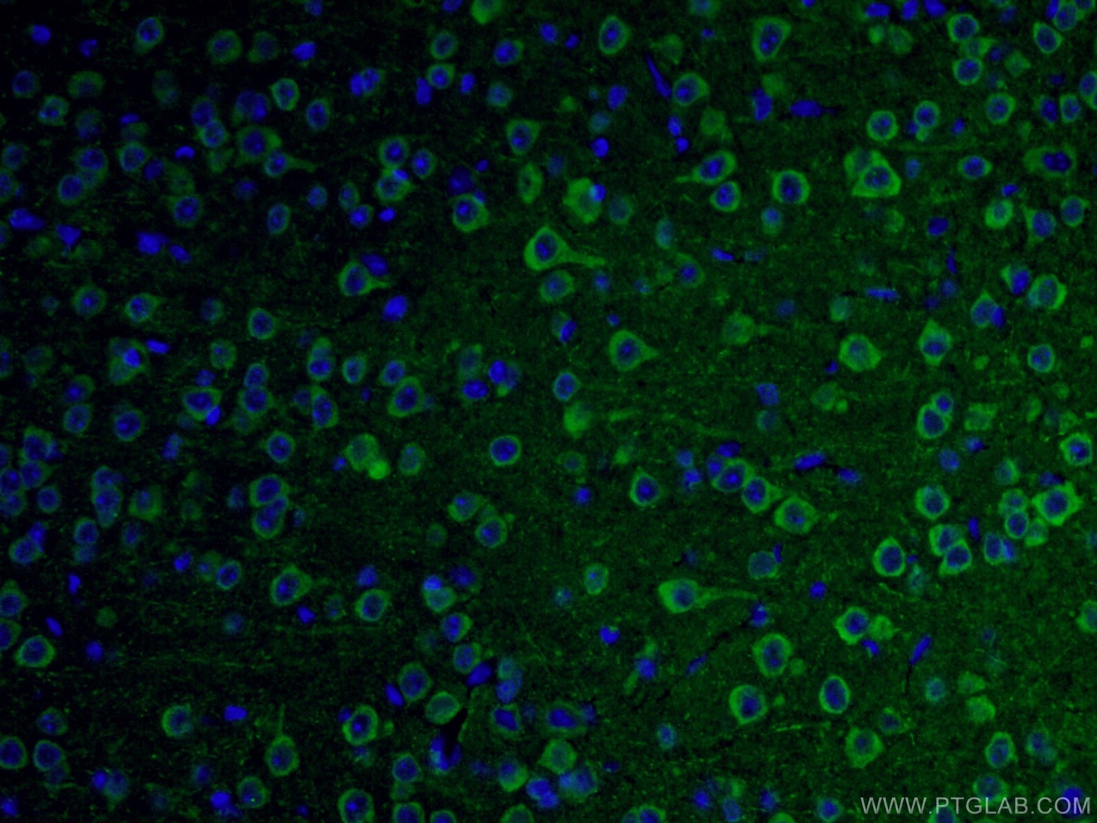 Immunofluorescence (IF) / fluorescent staining of mouse brain tissue using NF-H/NF200 Polyclonal antibody (18934-1-AP)