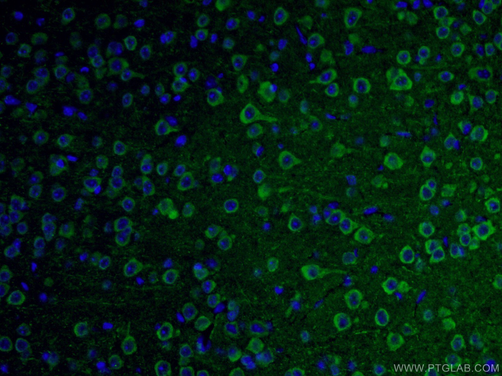 IF Staining of mouse brain using 18934-1-AP