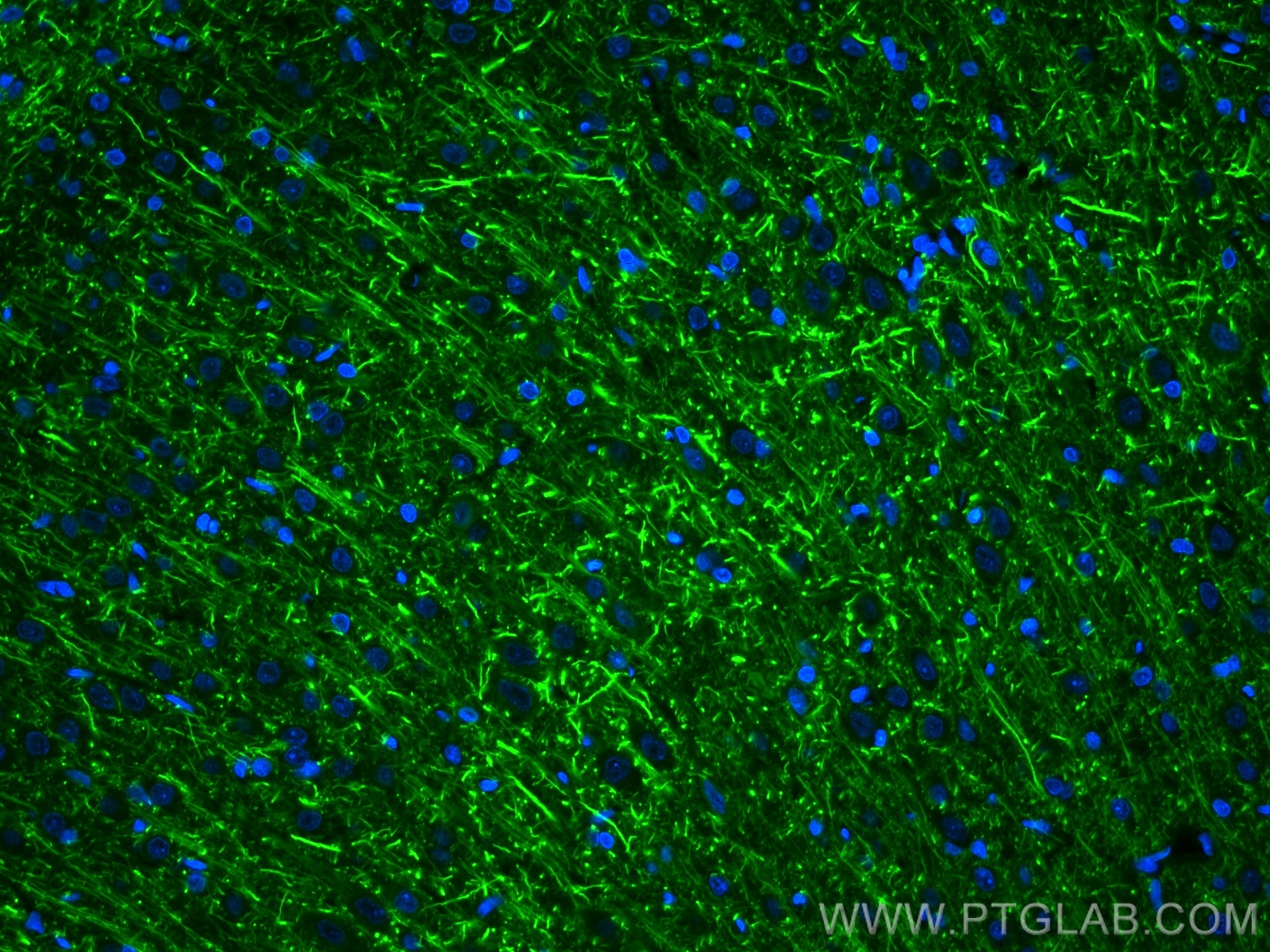 IF Staining of rat brain using 18934-1-AP