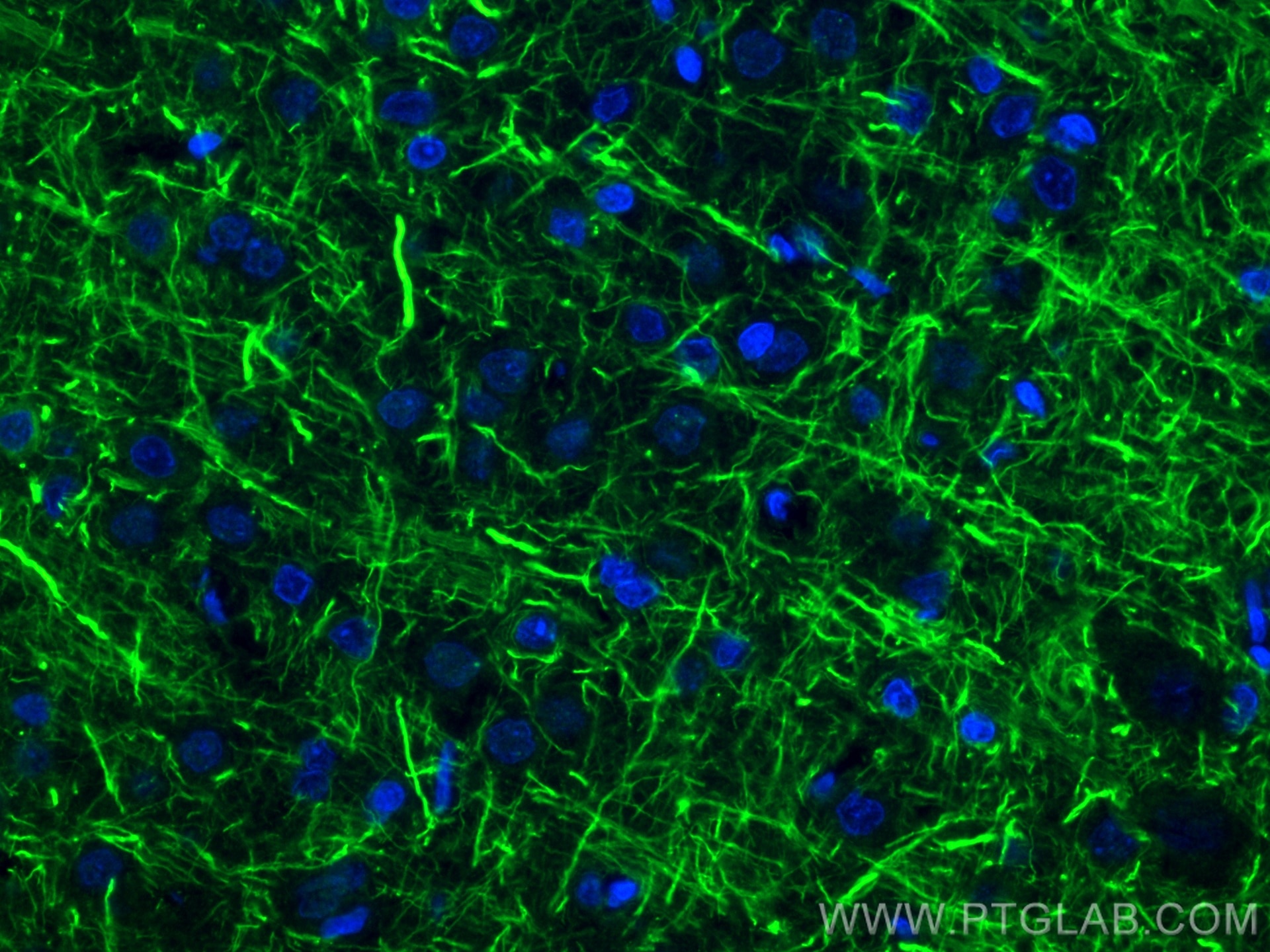 Immunofluorescence (IF) / fluorescent staining of rat brain tissue using NF-H/NF200 Polyclonal antibody (18934-1-AP)