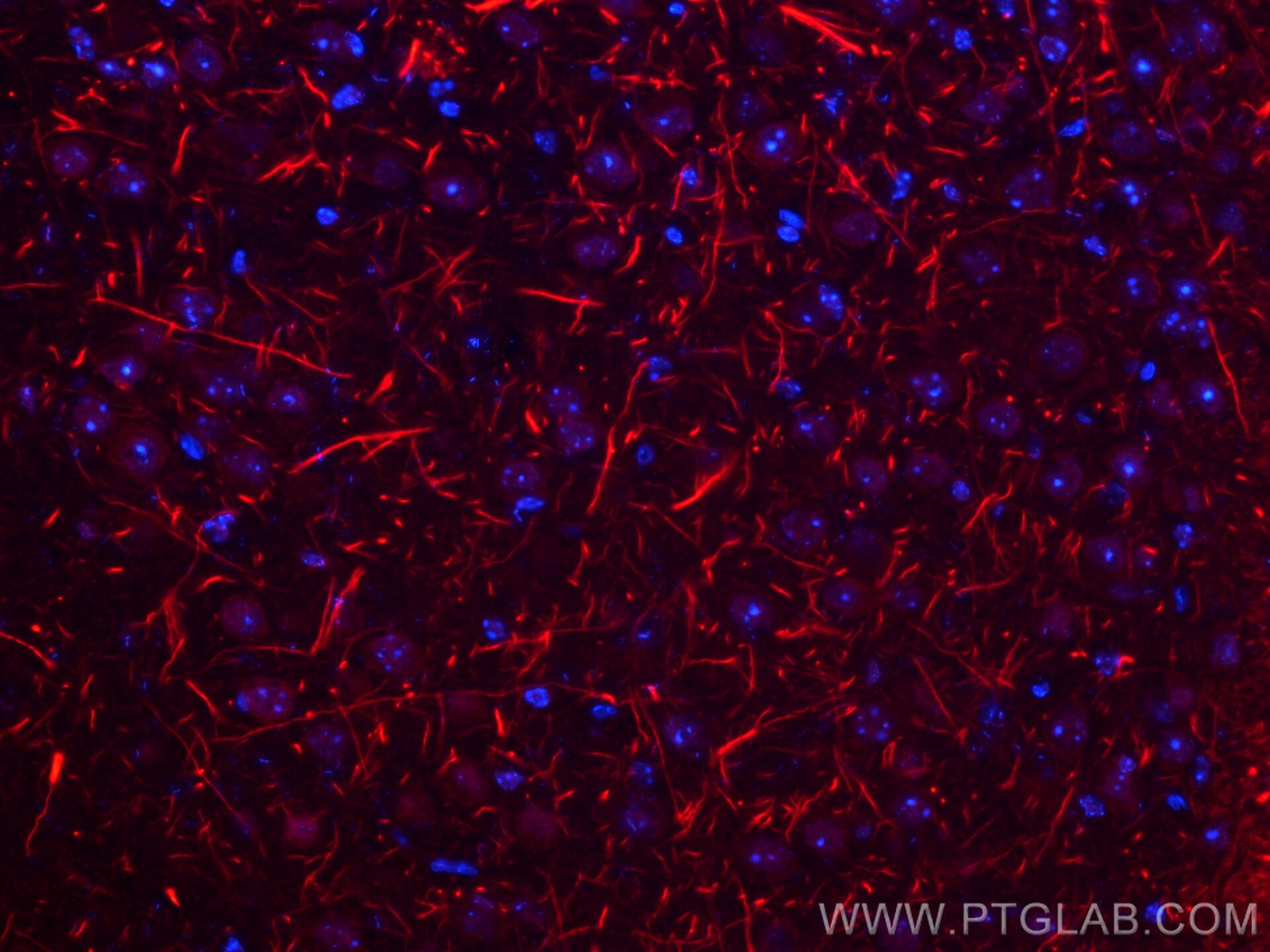 Immunofluorescence (IF) / fluorescent staining of mouse brain tissue using NF-H/NF200 Polyclonal antibody (18934-1-AP)