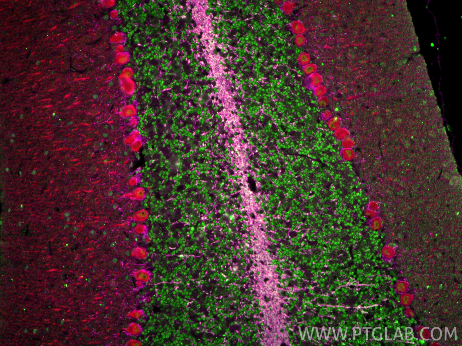 IF Staining of mouse cerebellum using 18934-1-AP Immunofluorescence (IF) / fluorescent staining of mouse cerebellum tissue using NF-H/NF200 Polyclonal antibody (18934-1-AP)