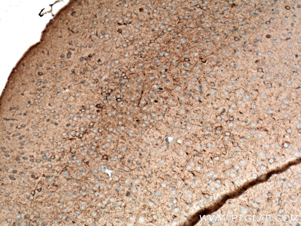 IHC staining of mouse brain using 18934-1-AP